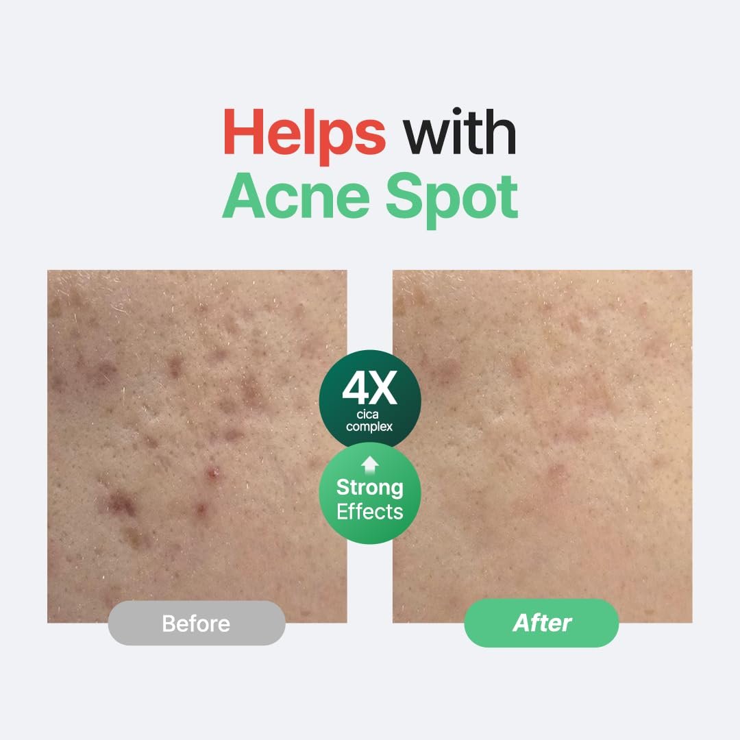 PURITO Centella Unscented Serum, 34,860 ppm Centella, Facial Serum for Sensitive Skin & Acne-Prone Skin, Soothing Serum, Vegan & Cruelty-Free, Korean Skincare, 2 fl.oz / 60ml - Image 2