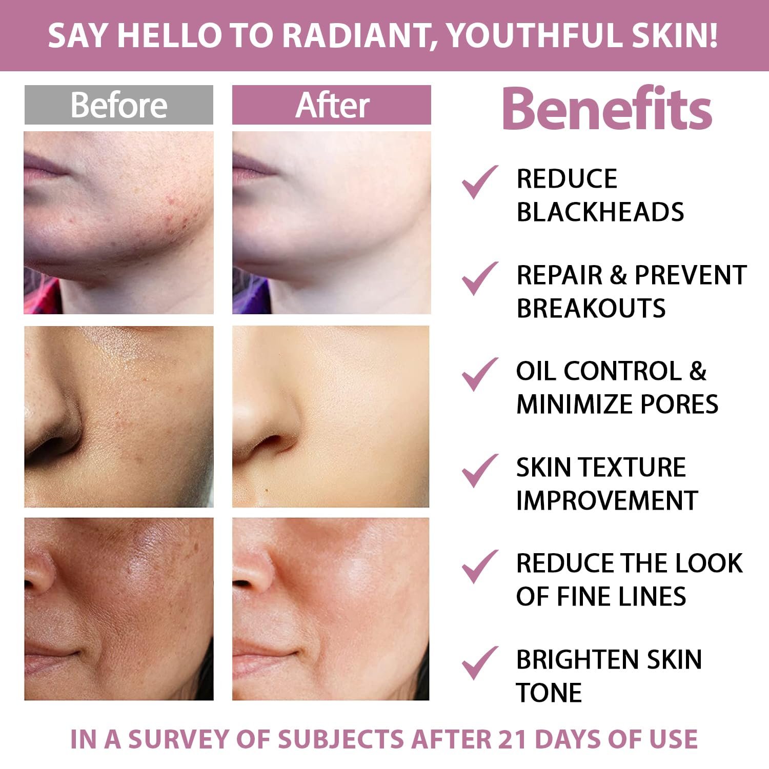 Glycolic Acid 20% & Salicylic Acid 2% Face Exfoliating Pads (50 Count)- Facial Peel Pads for Anti-Aging, Cleansing, Resurfacing, Brightening, Blemish Control, Revealing Clear, Glowing, Youthful Skin - Image 5