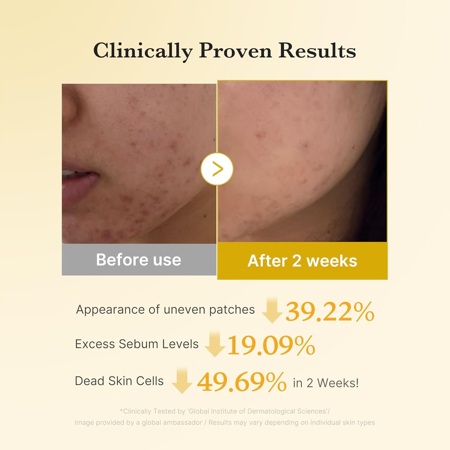 medicube Kojic Acid Turmeric Clarifying Toner Pad for Troubled Skin & Use After Spot Care, Soothing & Calming with Kojic Acid, Turmeric, Niacinamide & Glycolic Acid, Korean Skin Care, 70 Pads, 1 Pack - Image 4