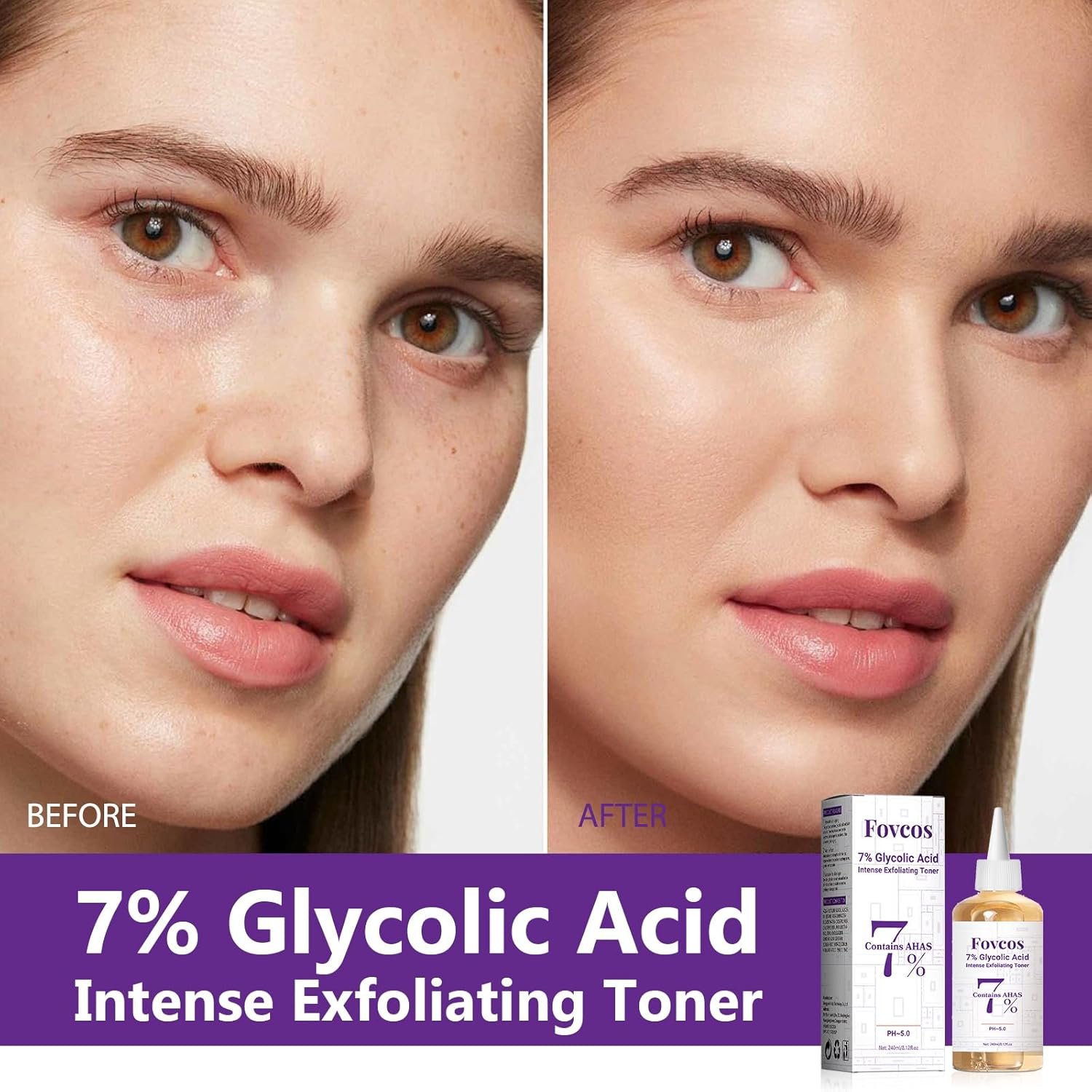 7% Glycolic Acid Exfoliating Toner, Exfoliating Skin Care Facial Toner, Improves Texture, Reduces Breakouts Pores and Fine Lines, Suitable for All Skin Types - Image 4